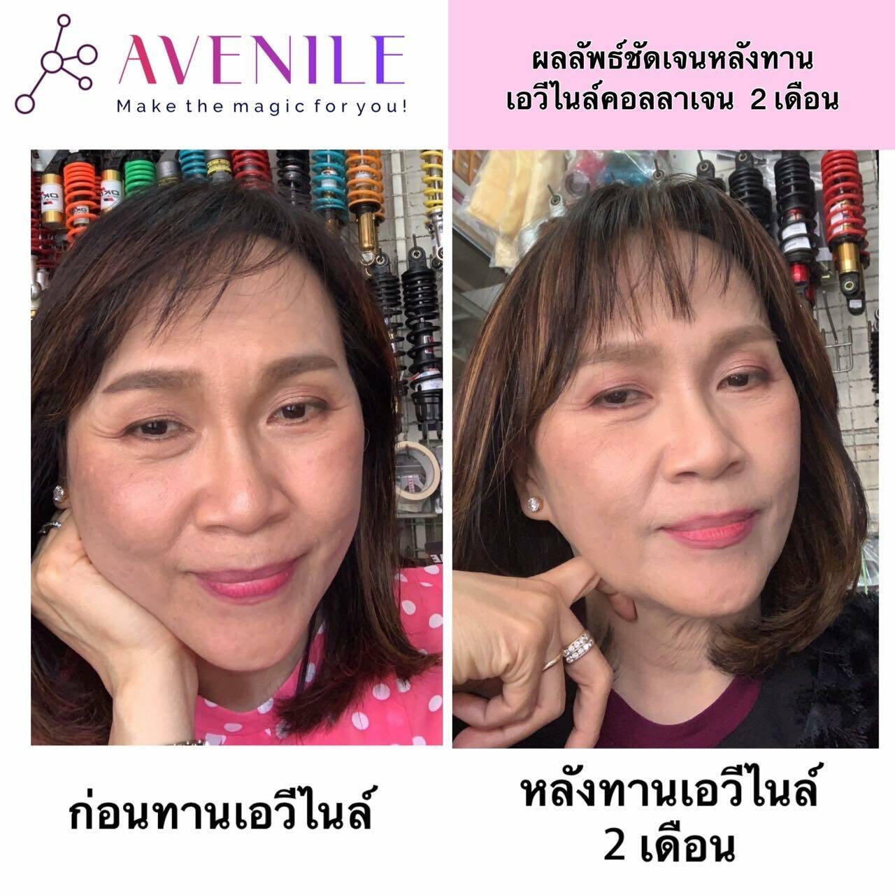 avenile คอลลาเจน ย้อนวัย ผิวลื่นขึ้น